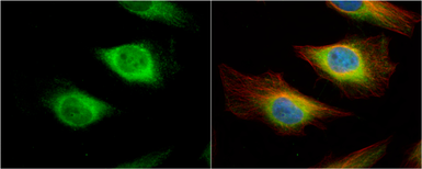 Anti-Creatine kinase (brain) antibody [N1C1] used in Immunocytochemistry/ Immunofluorescence (ICC/IF). GTX101759