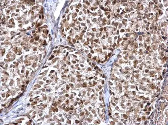 Anti-FEN1 antibody used in IHC (Paraffin sections) (IHC-P). GTX101777