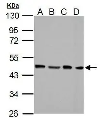 Anti-FEN1 antibody used in Western Blot (WB). GTX101777