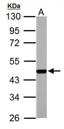 Anti-FEN1 antibody used in Western Blot (WB). GTX101777