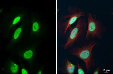 Anti-FEN1 antibody used in Immunocytochemistry/ Immunofluorescence (ICC/IF). GTX101777