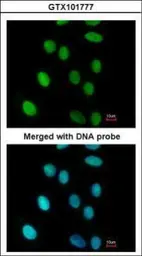 Anti-FEN1 antibody used in Immunocytochemistry/ Immunofluorescence (ICC/IF). GTX101777