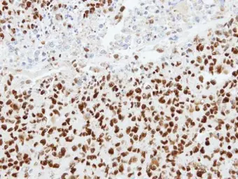 Anti-hnRNP K antibody used in IHC (Paraffin sections) (IHC-P). GTX101786
