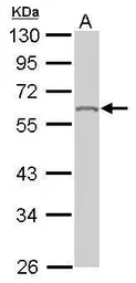 Anti-hnRNP K antibody used in Western Blot (WB). GTX101786