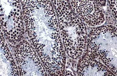 Anti-hnRNP K antibody used in IHC (Paraffin sections) (IHC-P). GTX101786