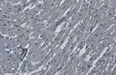 Anti-hnRNP K antibody used in IHC (Paraffin sections) (IHC-P). GTX101786