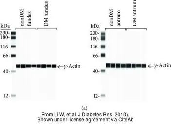Anti-Actin Gamma 1 antibody used in Western Blot (WB). GTX101794