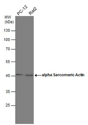 Anti-Actin Gamma 1 antibody used in Western Blot (WB). GTX101794