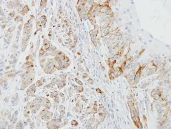 Anti-EPB41L3 antibody [C3], C-term used in IHC (Paraffin sections) (IHC-P). GTX101805