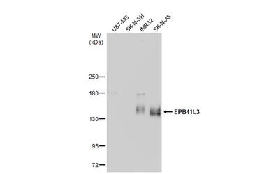 Anti-EPB41L3 antibody [C3], C-term used in Western Blot (WB). GTX101805