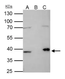 Anti-Fibrillarin antibody used in Immunoprecipitation (IP). GTX101807