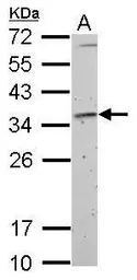 Anti-Fibrillarin antibody used in Western Blot (WB). GTX101807