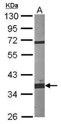 Anti-Fibrillarin antibody used in Western Blot (WB). GTX101807