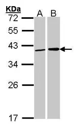 Anti-Fibrillarin antibody used in Western Blot (WB). GTX101807