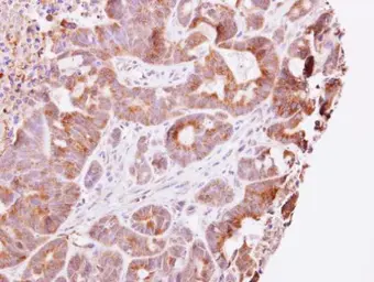 Anti-Guanylate kinase antibody used in IHC (Paraffin sections) (IHC-P). GTX101812