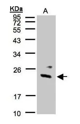 Anti-Guanylate kinase antibody used in Western Blot (WB). GTX101812
