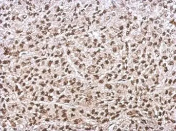 Anti-Ku70 antibody used in IHC (Paraffin sections) (IHC-P). GTX101820