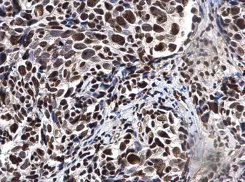 Anti-Ku70 antibody used in IHC (Paraffin sections) (IHC-P). GTX101820