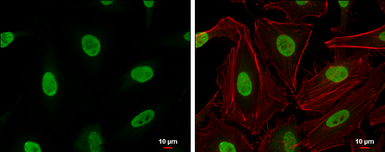 Anti-Ku70 antibody used in Immunocytochemistry/ Immunofluorescence (ICC/IF). GTX101820
