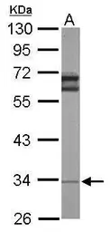 Anti-RPL5 antibody used in Western Blot (WB). GTX101821