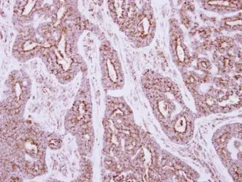 Anti-NDUFS5 antibody used in IHC (Paraffin sections) (IHC-P). GTX101829