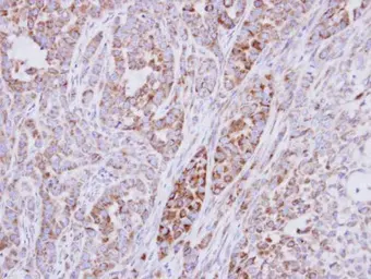 Anti-RPS10 antibody used in IHC (Paraffin sections) (IHC-P). GTX101836