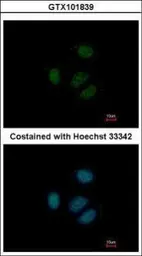 Anti-RPS15 antibody used in Immunocytochemistry/ Immunofluorescence (ICC/IF). GTX101839