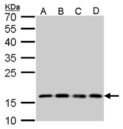 Anti-RPS15 antibody used in Western Blot (WB). GTX101839