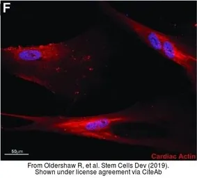 Anti-alpha Cardiac Muscle Actin antibody used in Immunocytochemistry/ Immunofluorescence (ICC/IF). GTX101876