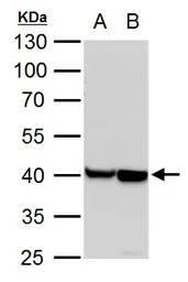 Anti-alpha Cardiac Muscle Actin antibody used in Western Blot (WB). GTX101876