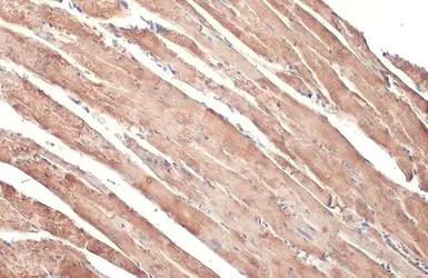 Anti-alpha Cardiac Muscle Actin antibody used in IHC (Paraffin sections) (IHC-P). GTX101876