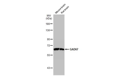 Anti-GAD67 antibody used in Western Blot (WB). GTX101881