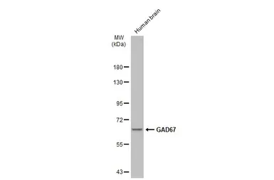 Anti-GAD67 antibody used in Western Blot (WB). GTX101881