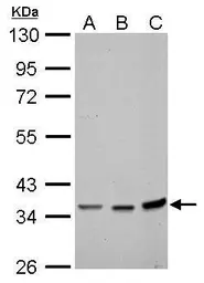 Anti-Annexin II antibody used in Western Blot (WB). GTX101902