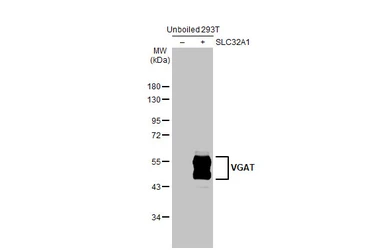 Anti-VGAT antibody [N1N2], N-term used in Western Blot (WB). GTX101908