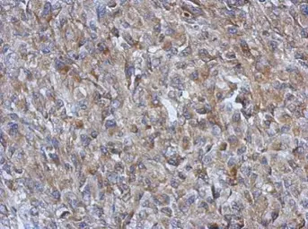 Anti-GOT2 antibody used in IHC (Paraffin sections) (IHC-P). GTX101929