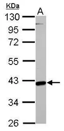 Anti-GOT2 antibody used in Western Blot (WB). GTX101929