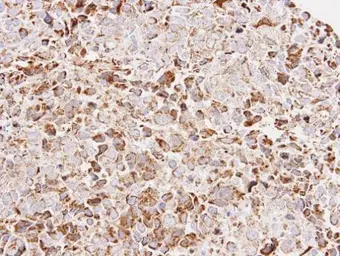 Anti-ATP5O antibody [N1C3] used in IHC (Paraffin sections) (IHC-P). GTX101942