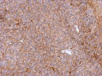 Anti-PHGDH antibody [N1N2], N-term used in IHC (Paraffin sections) (IHC-P). GTX101948
