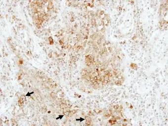 Anti-RAP1B antibody used in IHC (Paraffin sections) (IHC-P). GTX101950