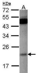 Anti-RAP1B antibody used in Western Blot (WB). GTX101950