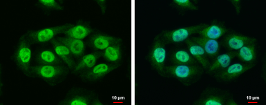Anti-RAP1 antibody [N2C3] used in Immunocytochemistry/ Immunofluorescence (ICC/IF). GTX101983