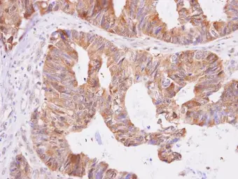 Anti-Aspartyl aminopeptidase antibody [N1N3] used in IHC (Paraffin sections) (IHC-P). GTX101993