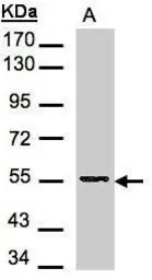 Anti-Aspartyl aminopeptidase antibody [N1N3] used in Western Blot (WB). GTX101993