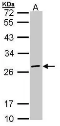 Anti-EIF3K antibody [N1C2] used in Western Blot (WB). GTX101996