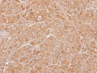 Anti-ZNHIT1 antibody [N1C3] used in IHC (Paraffin sections) (IHC-P). GTX102030