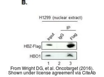 Anti-MYST2 antibody [N2C1], Internal used in Western Blot (WB). GTX102041