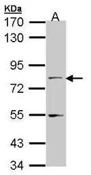 Anti-TAP antibody [C2C3], C-term used in Western Blot (WB). GTX102063