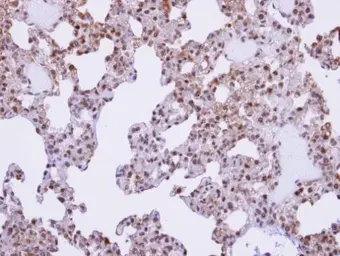 Anti-SFRS17A antibody [C2C3], C-term used in IHC (Paraffin sections) (IHC-P). GTX102065