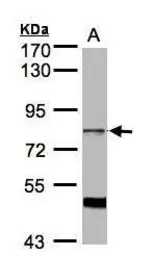 Anti-SFRS17A antibody [C2C3], C-term used in Western Blot (WB). GTX102065